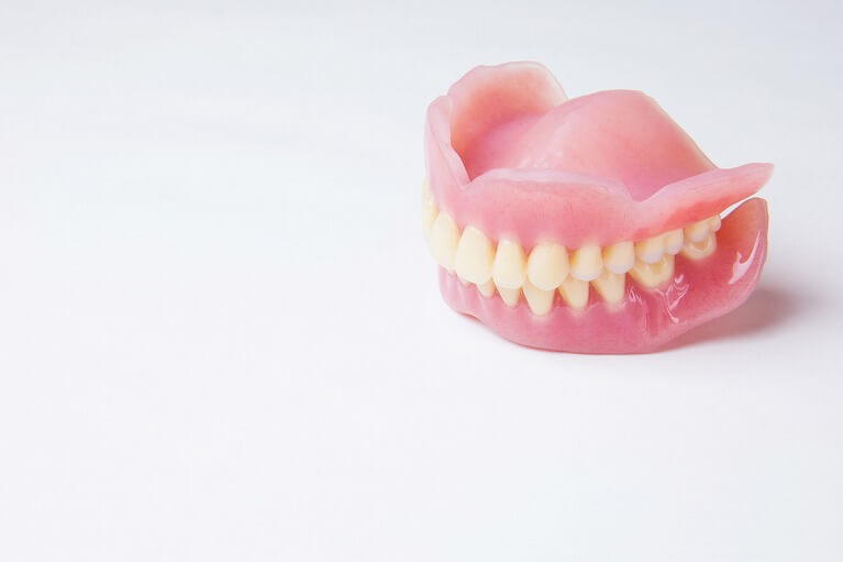 総入れ歯（全ての歯を失った場合）