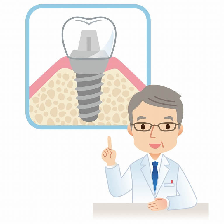 骨が足りない・薄いなどの骨造成手術